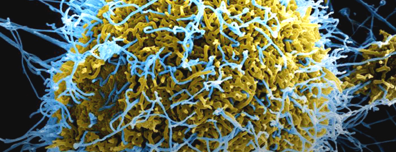 Ebola-Virus-v2